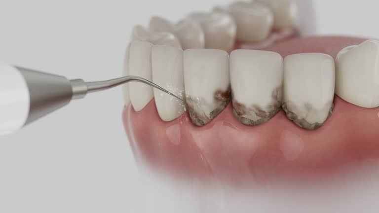 Reliable Dental Implants contractor in Saline County County, IL by Dentist Open Now